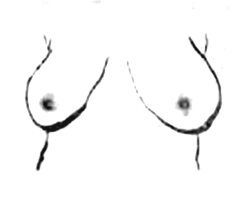 la forme de vos seins 2
